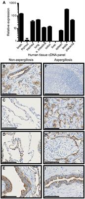 FIBCD1 Binds Aspergillus fumigatus and Regulates Lung Epithelial Response to Cell Wall Components